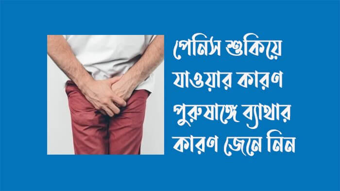 পেনিস-শুকিয়ে-যাওয়ার-কারণ-পুরুষাঙ্গে-ব্যাথার-কারণ